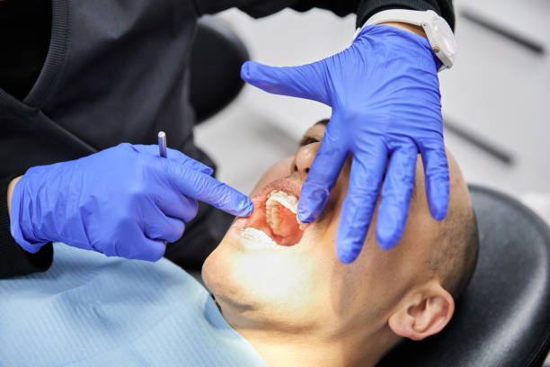 Best Emergency Tooth Extraction in Loughman, FL